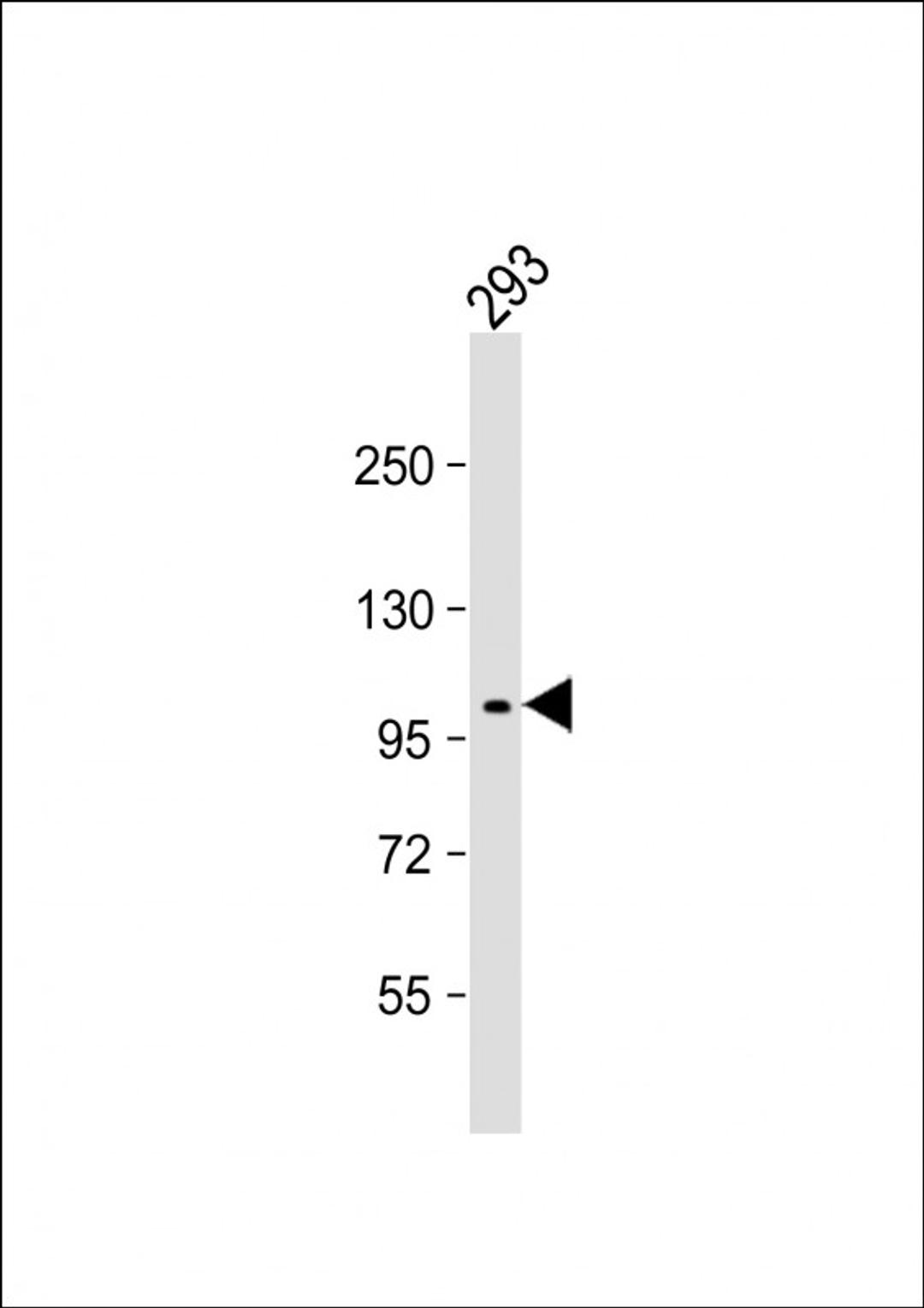 Western Blot at 1:2000 dilution + 293 whole cell lysate Lysates/proteins at 20 ug per lane.