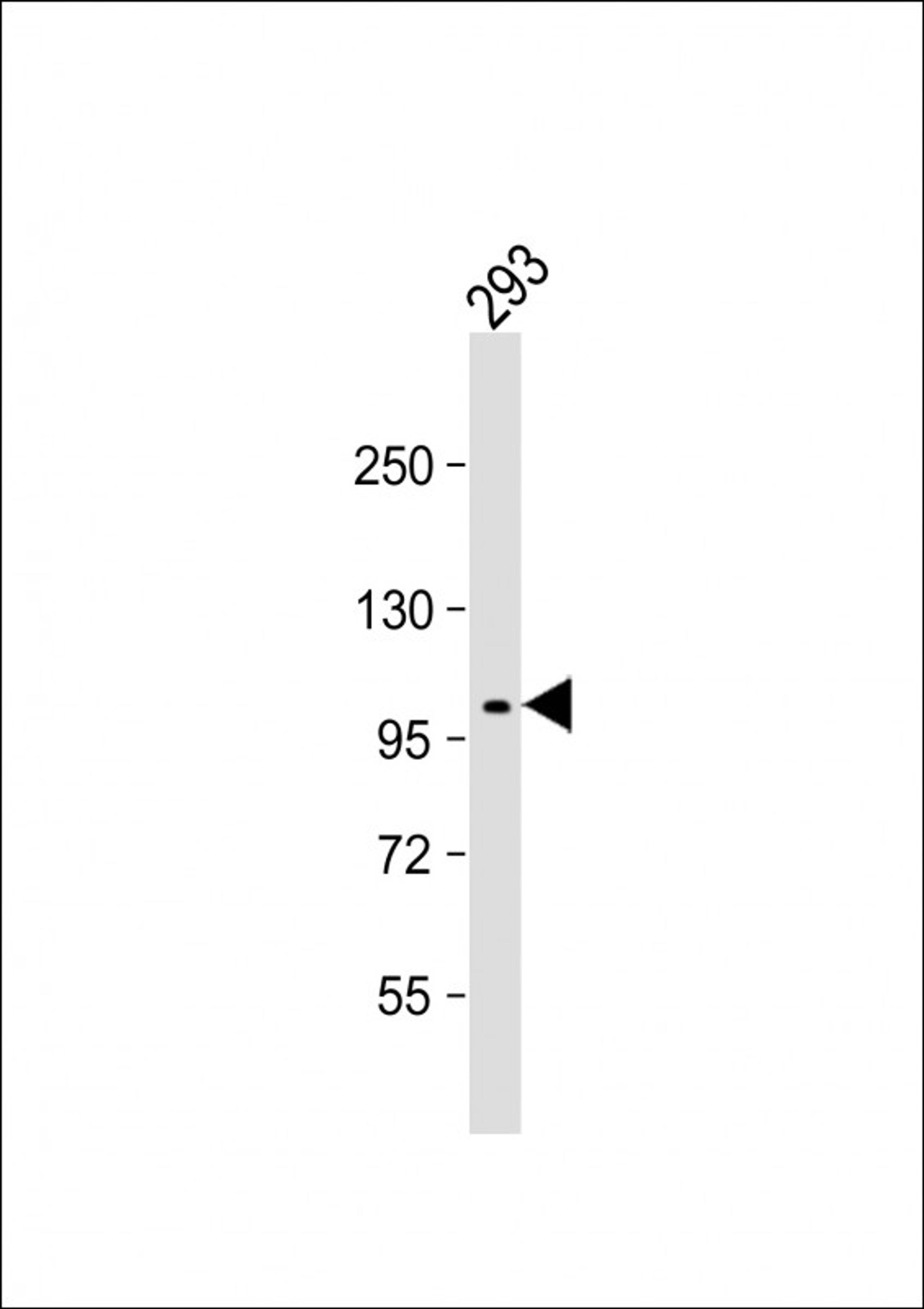 Western Blot at 1:2000 dilution + 293 whole cell lysate Lysates/proteins at 20 ug per lane.