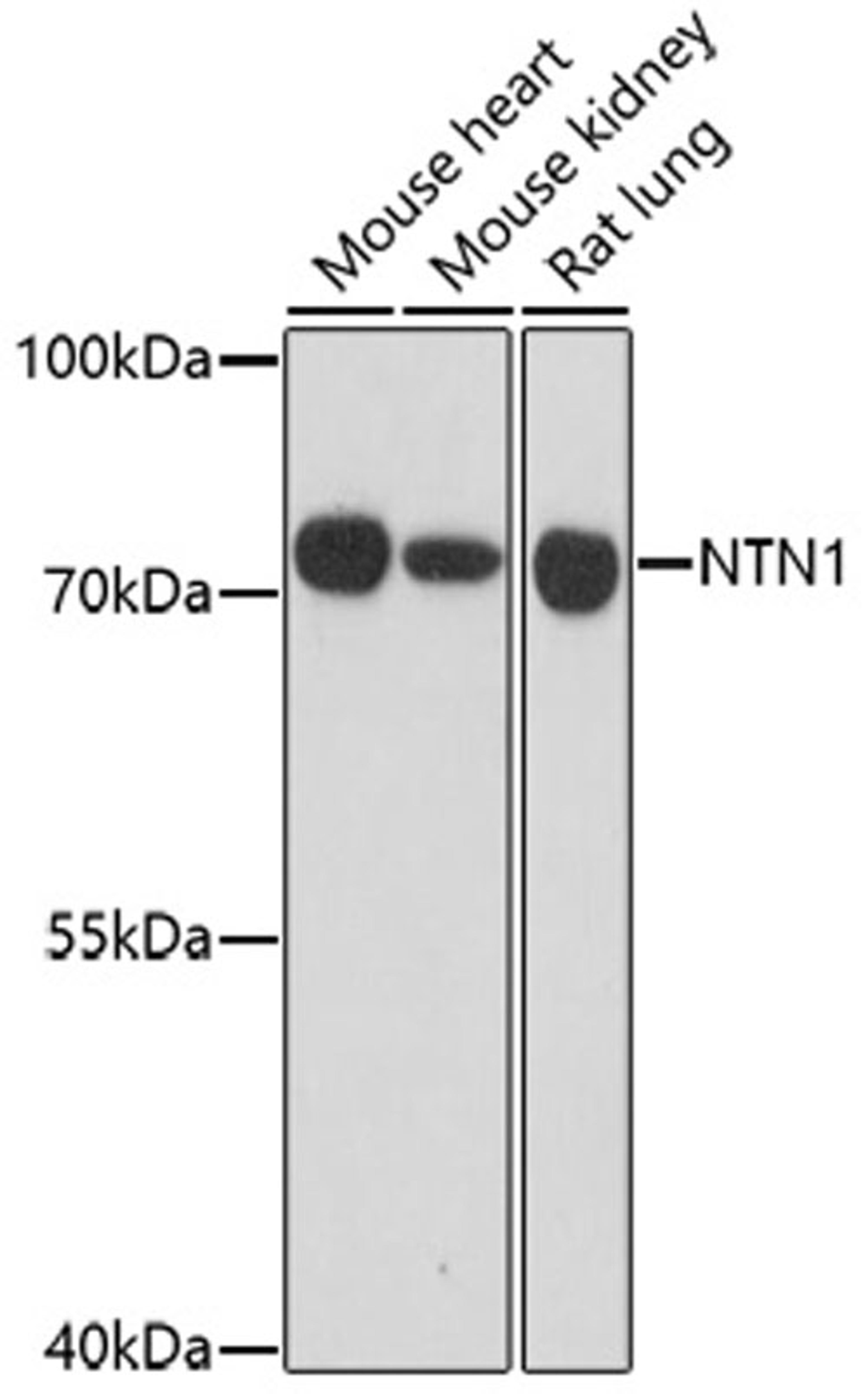 Western blot - NTN1 antibody (A16236)