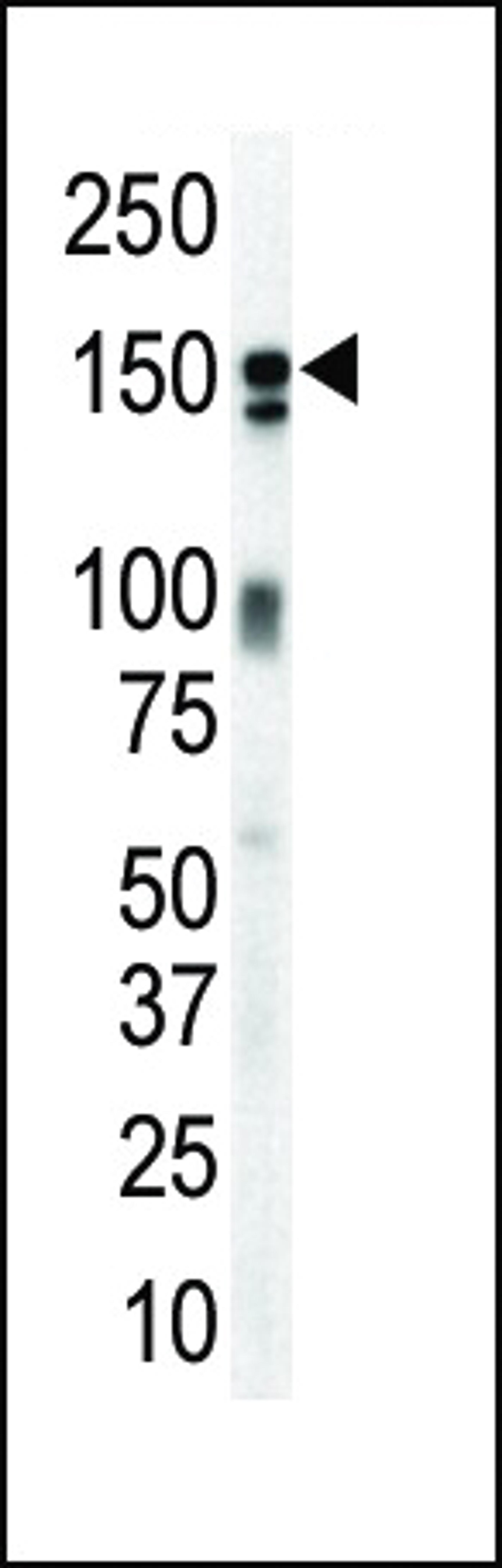 Western blot analysis of anti-ErbB3 Pab in mouse brain lysate