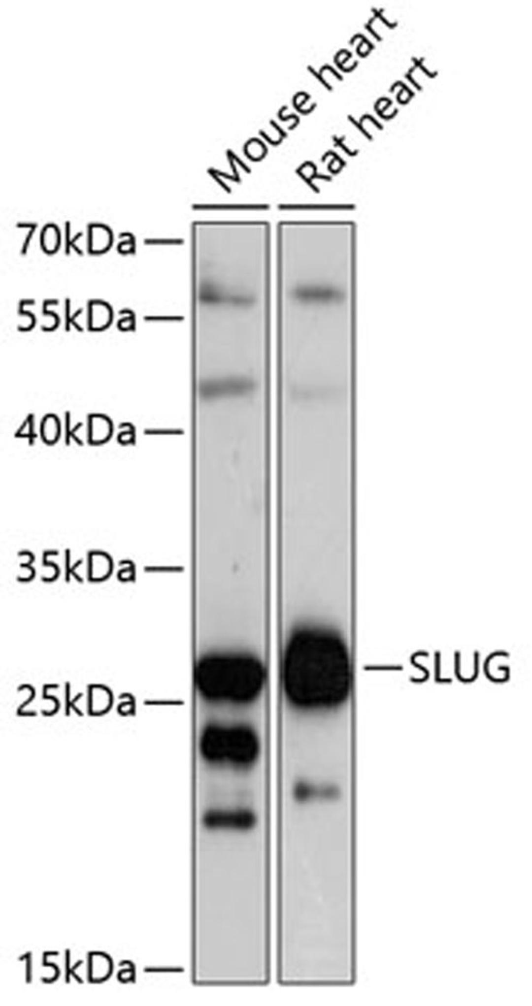 Western blot - Slug antibody (A1057)