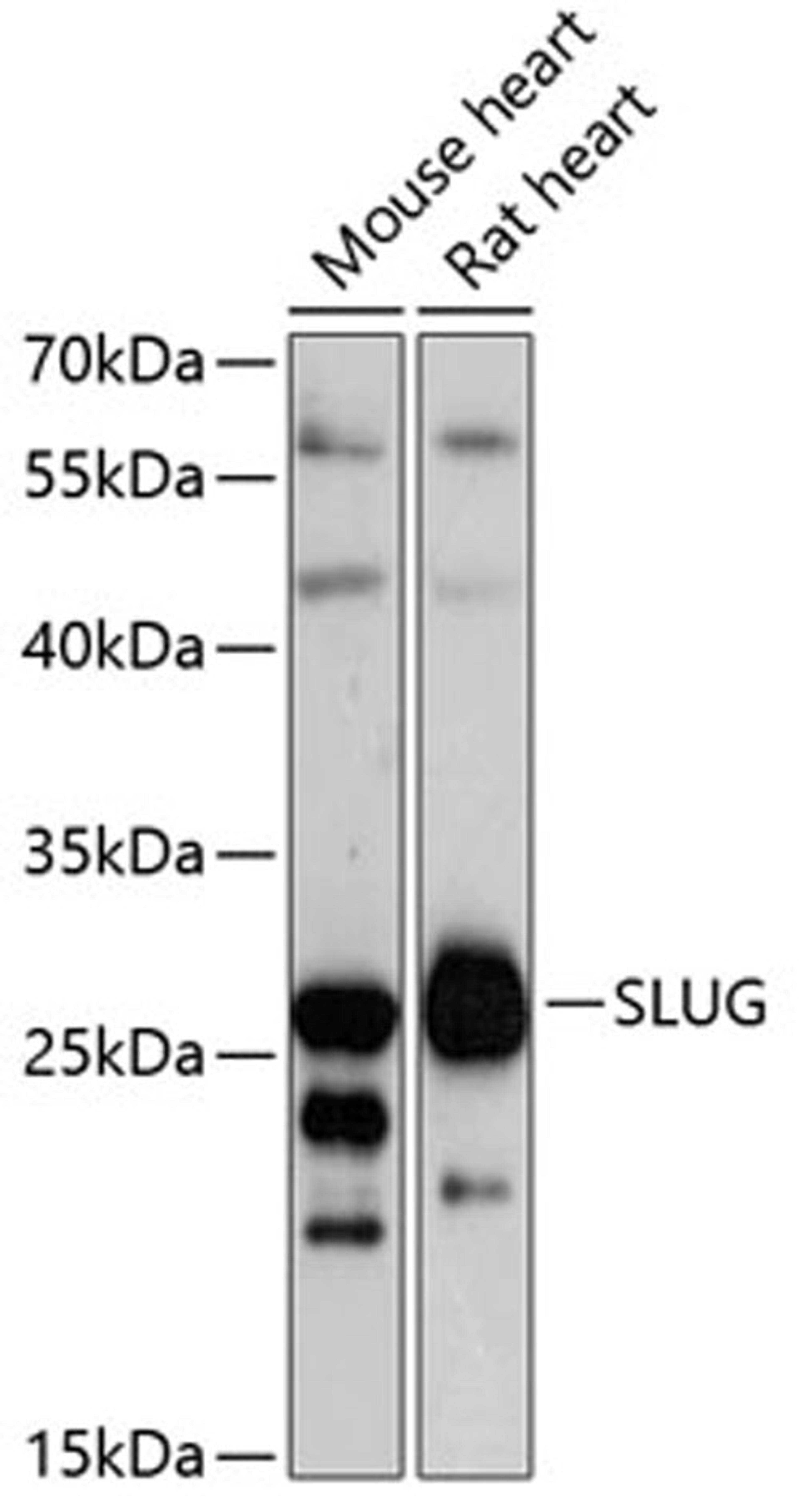 Western blot - Slug antibody (A1057)