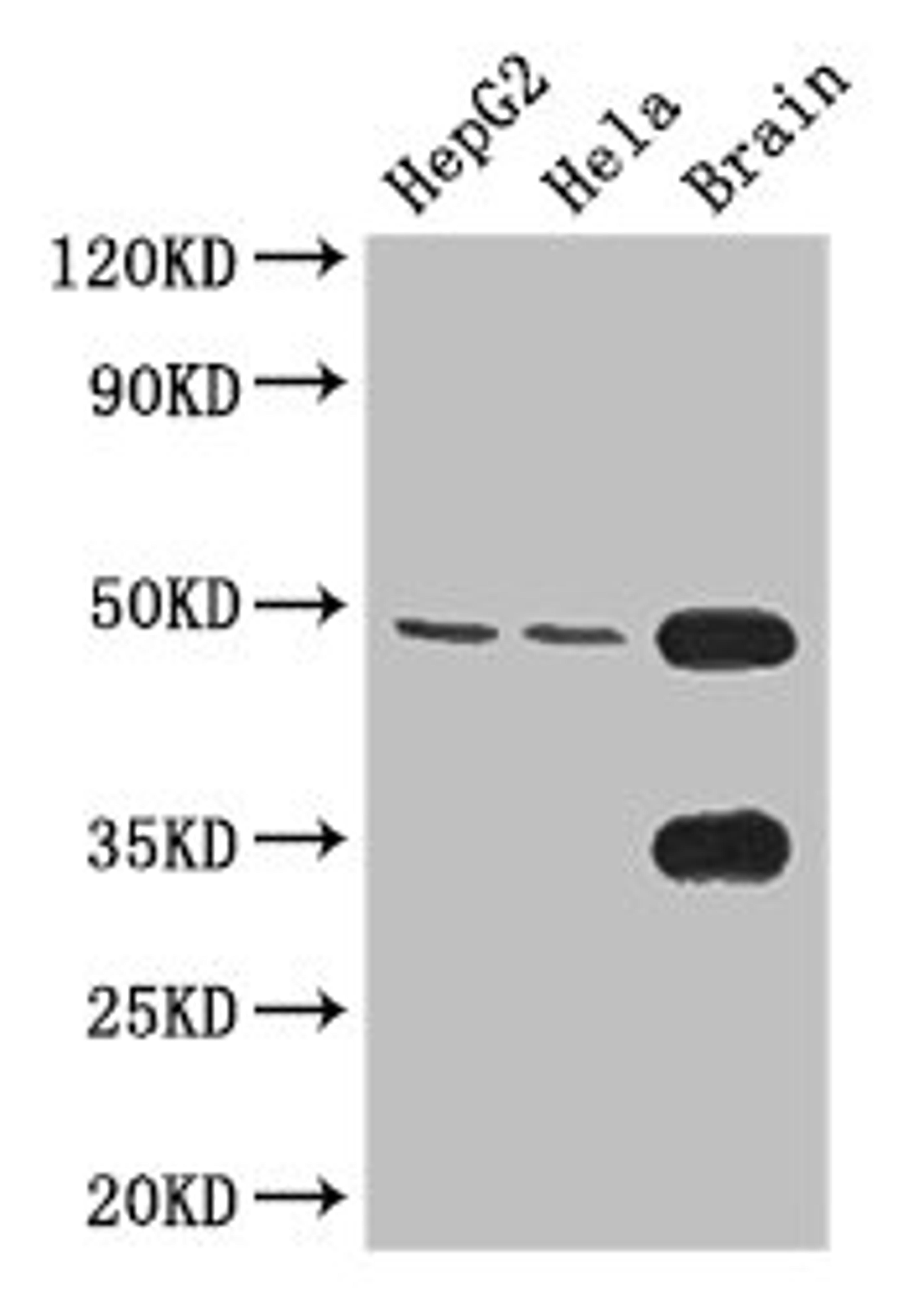 Western Blot. Positive WB detected in: HepG2 whole cell lysate, Hela whole cell lysate, Mouse brain tissue. All lanes: DNAAF4 antibody at 3.4µg/ml. Secondary. Goat polyclonal to rabbit IgG at 1/50000 dilution. Predicted band size: 49, 45 kDa. Observed band size: 49 kDa