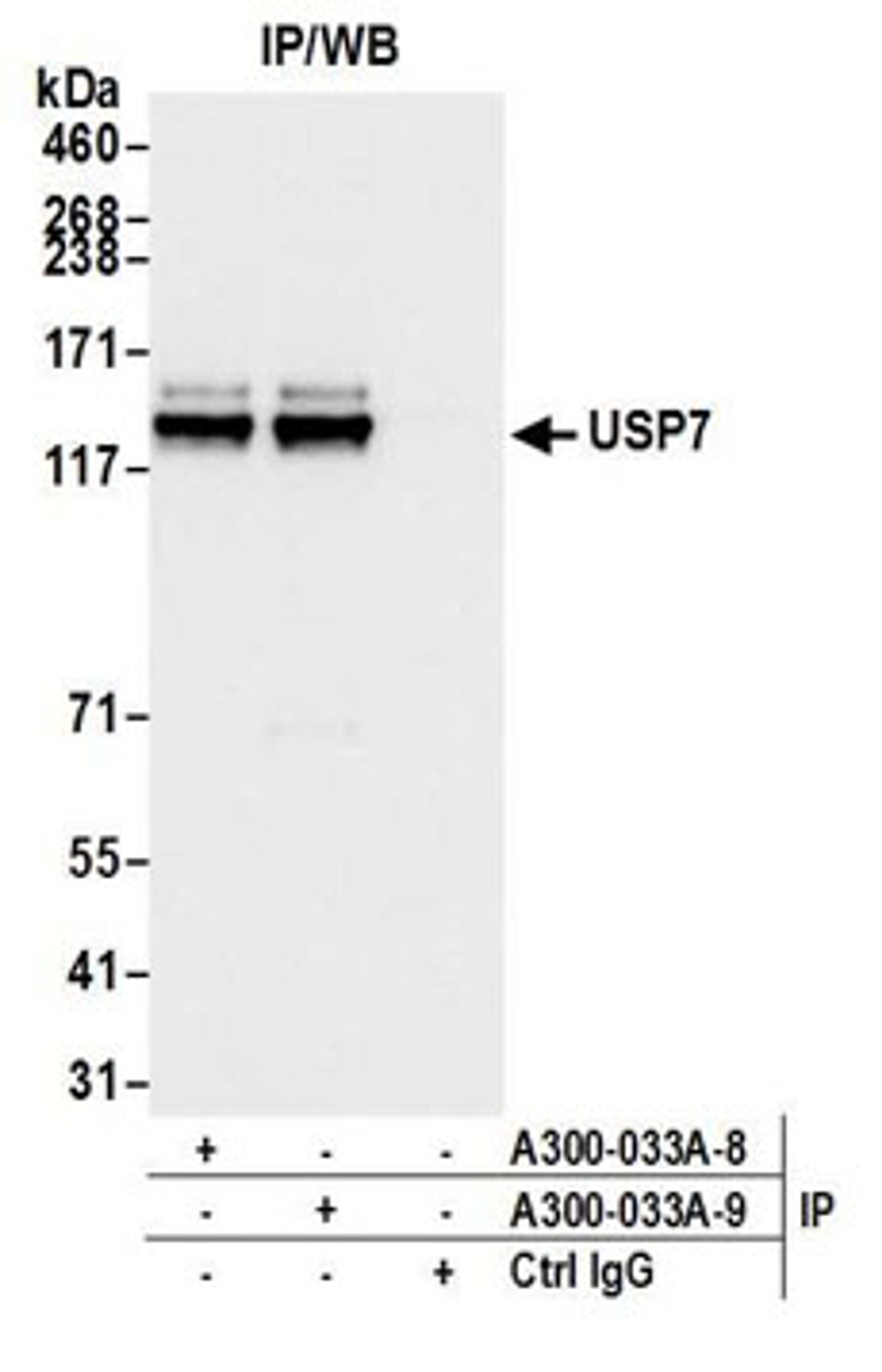 Detection of human USP7 by western blot of immunoprecipitates.