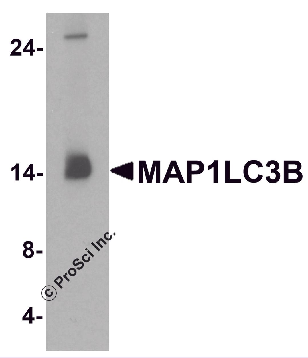 Western blot analysis of MAP1LC3B in human brain tissue lysate with MAP1LC3B antibody at 1 &#956;g/ml.