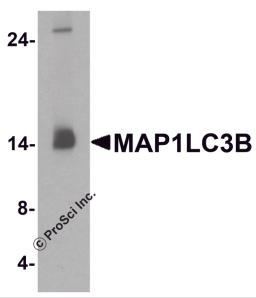 Western blot analysis of MAP1LC3B in human brain tissue lysate with MAP1LC3B antibody at 1 μg/ml.