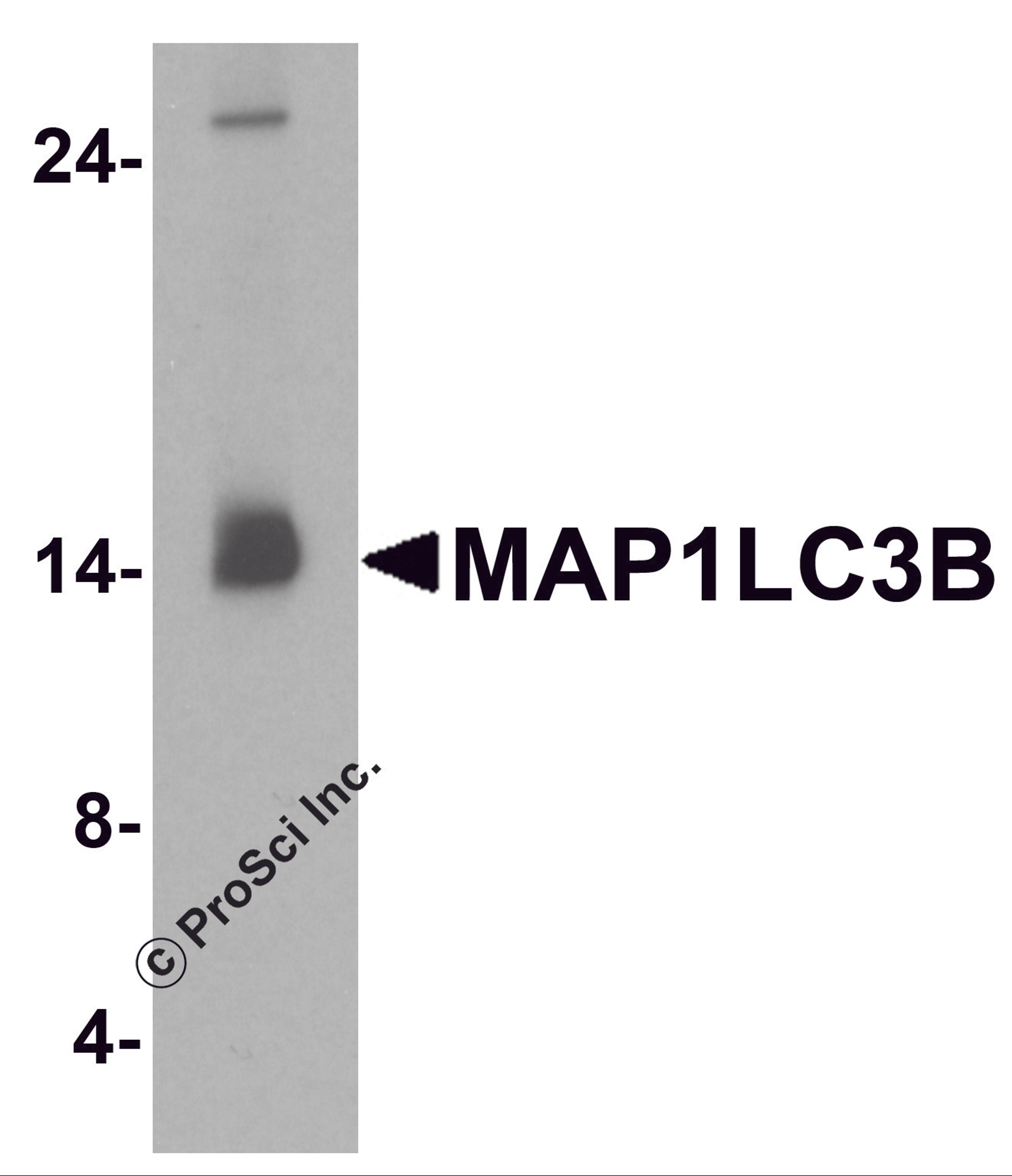 Western blot analysis of MAP1LC3B in human brain tissue lysate with MAP1LC3B antibody at 1 μg/ml.