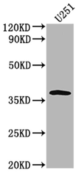 Western Blot. Positive WB detected in: U251 whole cell lysate. All lanes: OR6B3 antibody at 1:2000. Secondary. Goat polyclonal to rabbit IgG at 1/50000 dilution. Predicted band size: 38 kDa. Observed band size: 38 kDa.