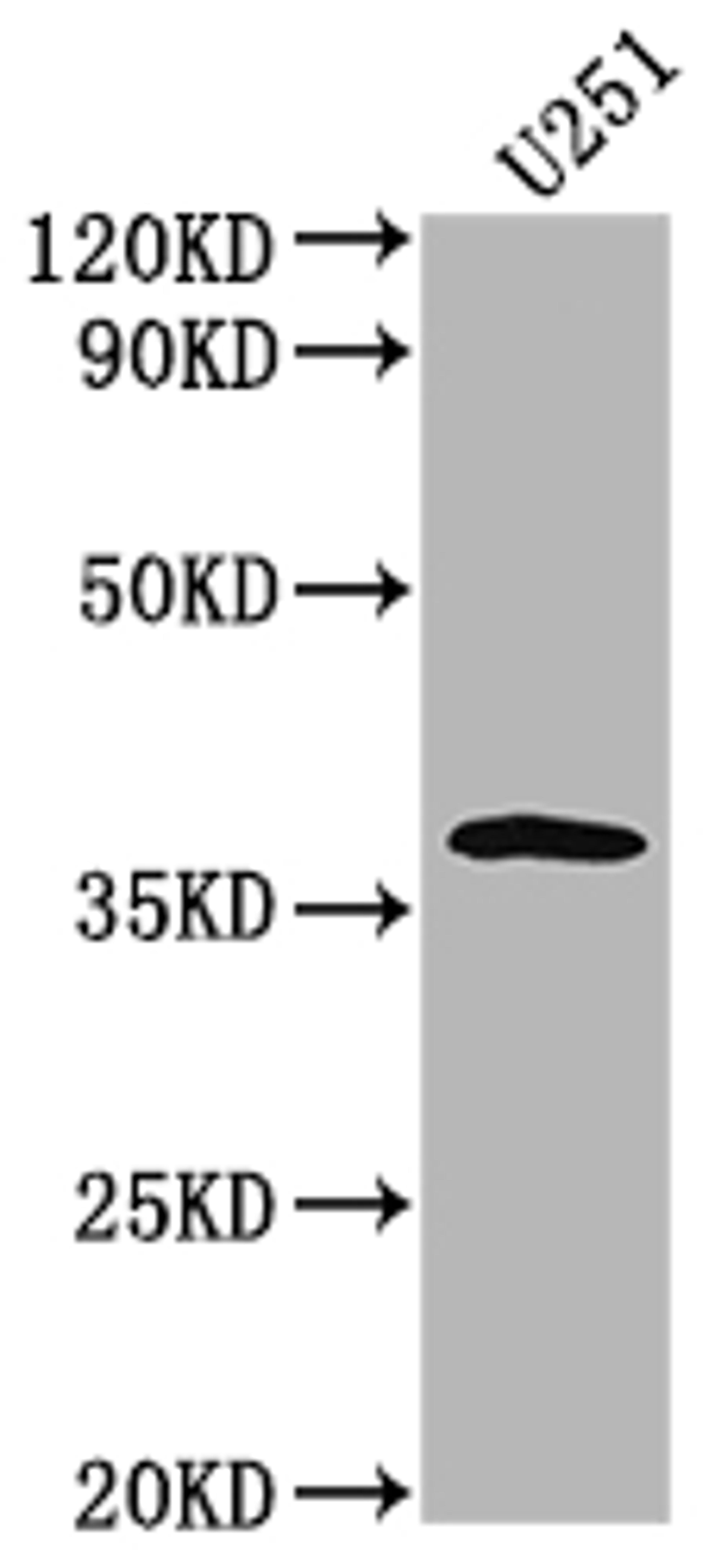 Western Blot. Positive WB detected in: U251 whole cell lysate. All lanes: OR6B3 antibody at 1:2000. Secondary. Goat polyclonal to rabbit IgG at 1/50000 dilution. Predicted band size: 38 kDa. Observed band size: 38 kDa.