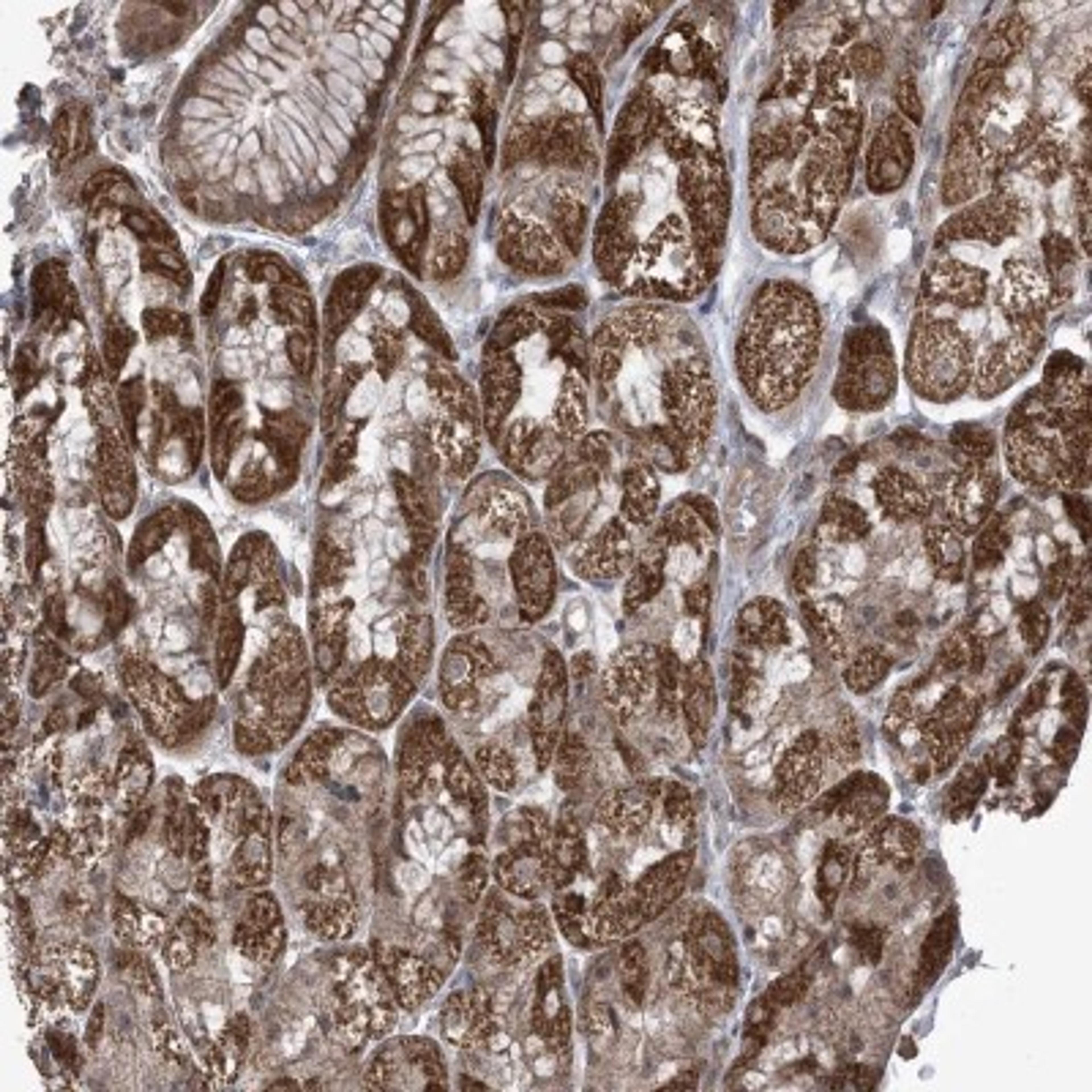 Immunohistochemistry: PHLDB2 Antibody [NBP2-38238] - Staining of human stomach, upper shows strong cytoplasmic positivity in granular pattern in glandular cells.