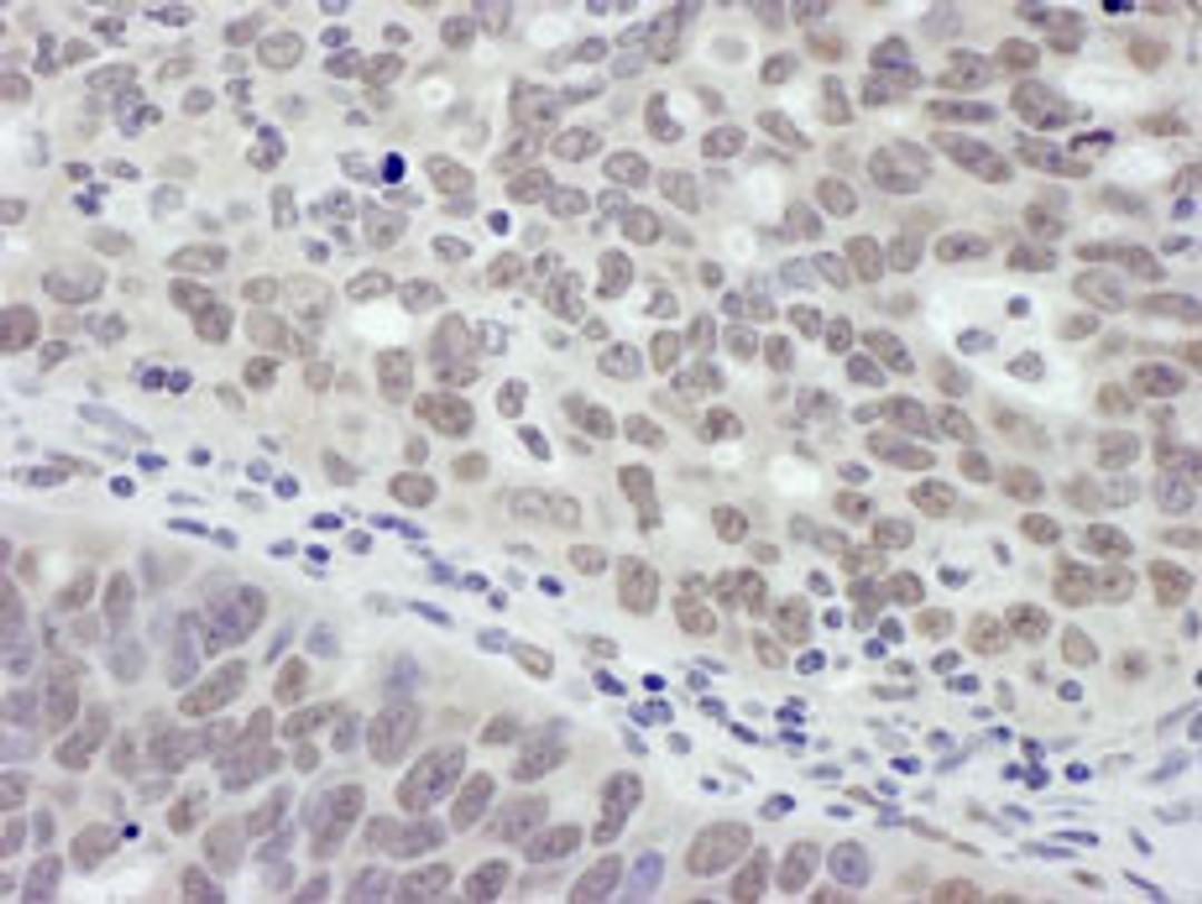 Detection of human MTA1 by immunohistochemistry.