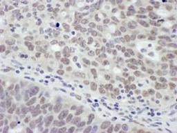 Detection of human MTA1 by immunohistochemistry.