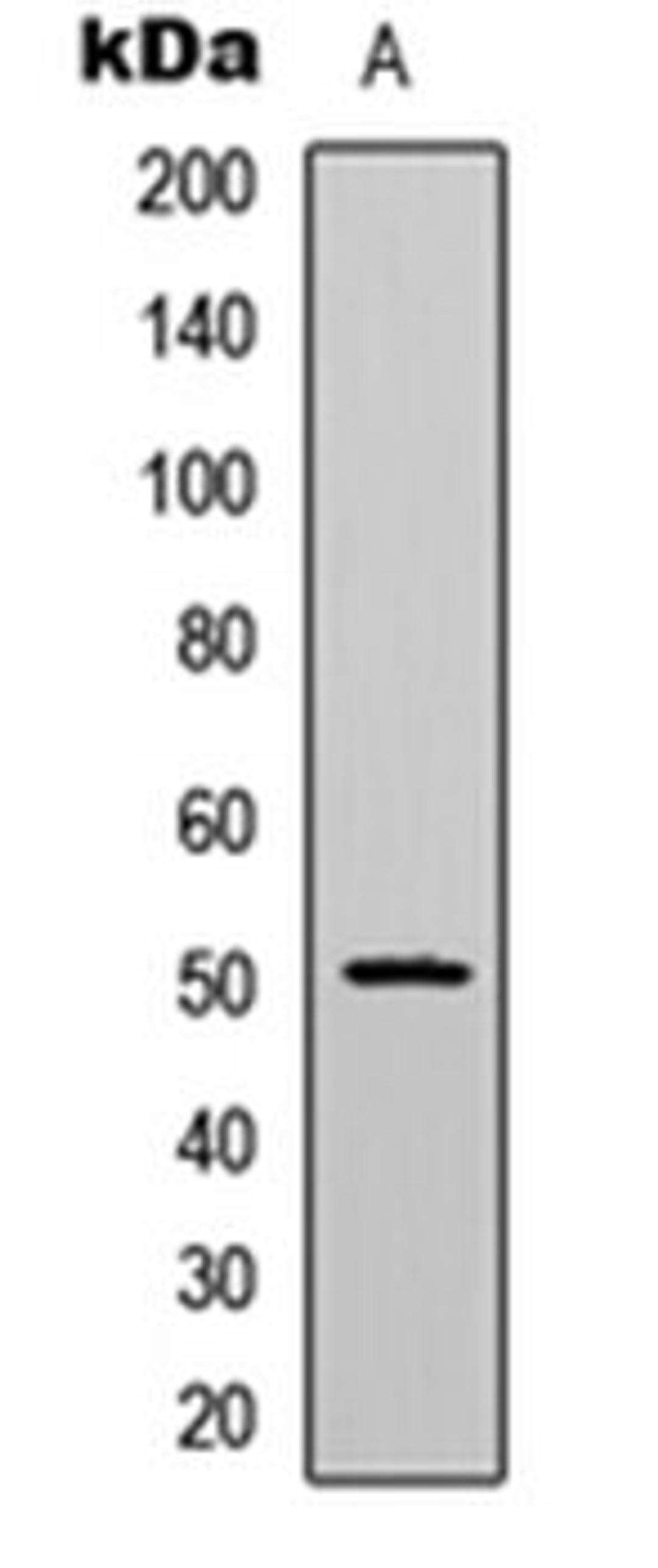 Western blot analysis of HeLa (Lane 1) whole cell lysates using CaMK2 alpha/delta (phospho-T286) antibody