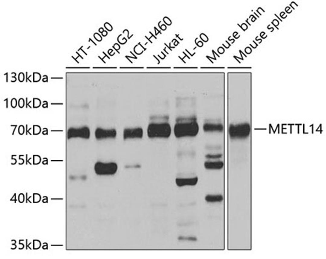 Western blot - METTL14 antibody (A8530)