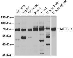 Western blot - METTL14 antibody (A8530)