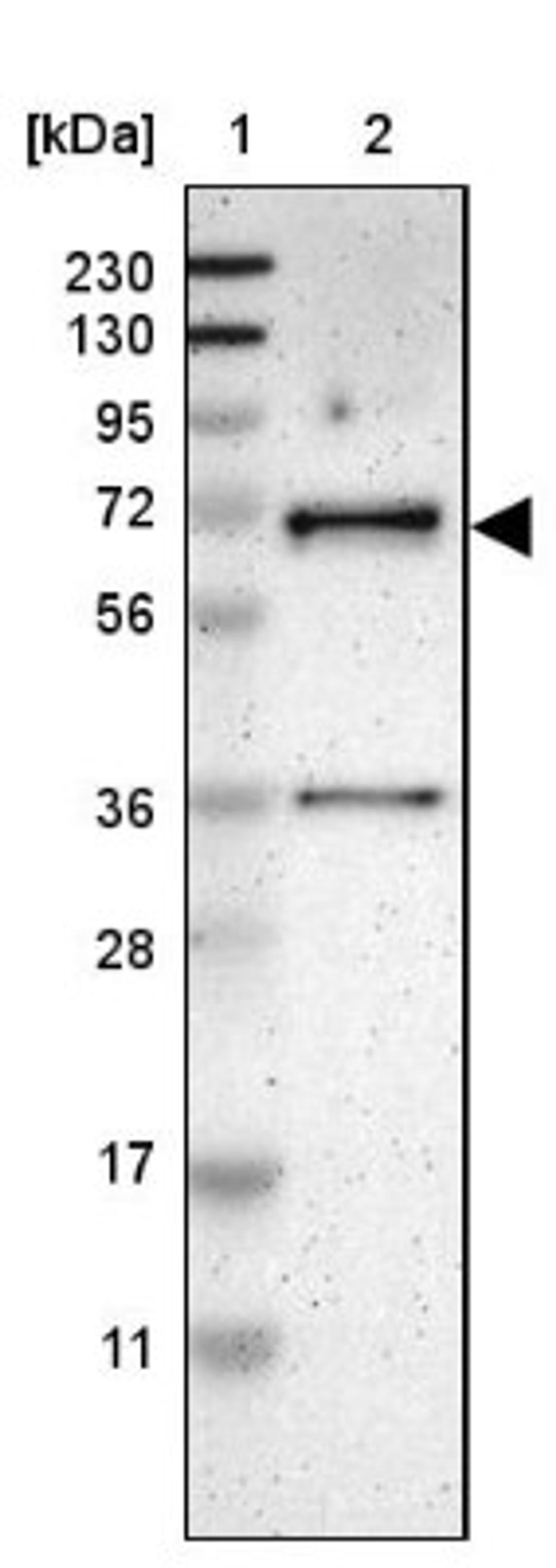 Western Blot: LAD1 Antibody [NBP1-86126] - Lane 1: Marker [kDa] 230, 130, 95, 72, 56, 36, 28, 17, 11<br/>Lane 2: Human cell line RT-4