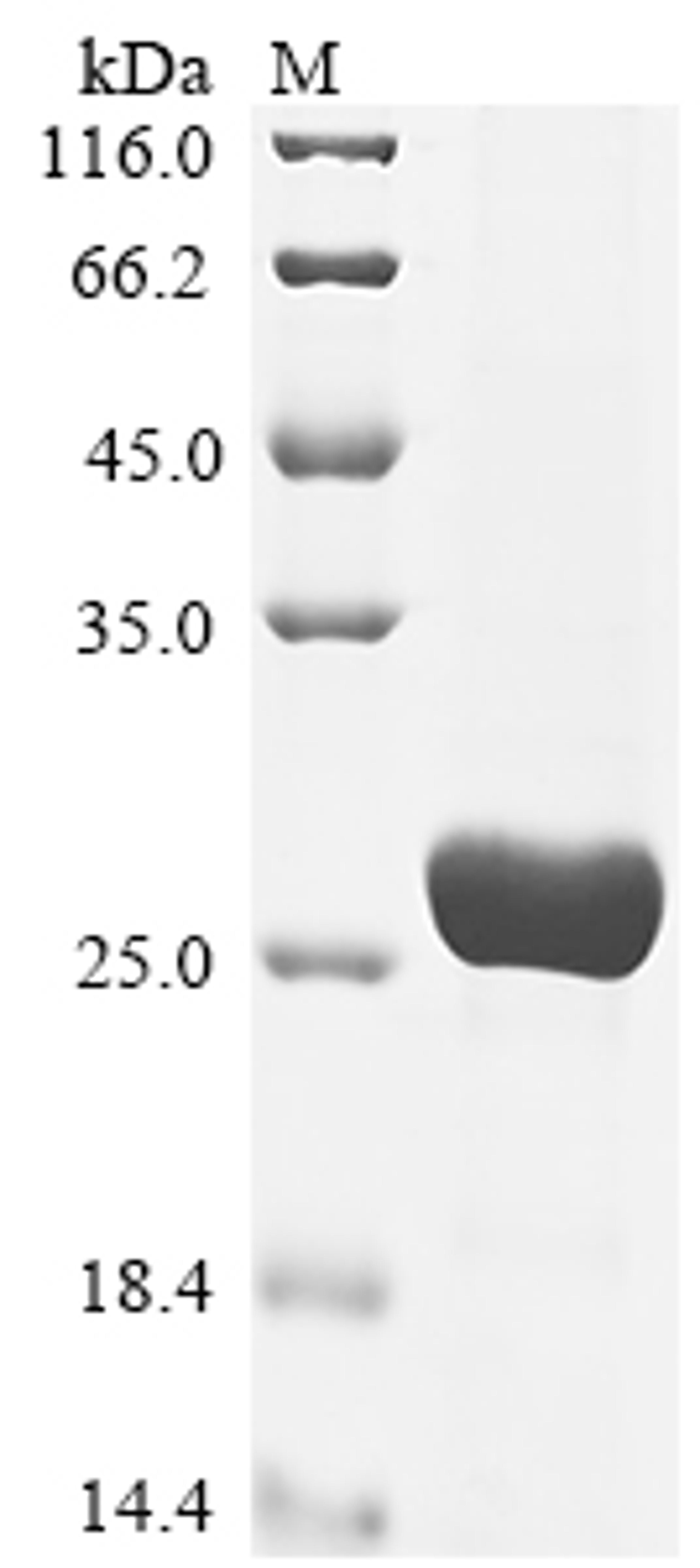 (Tris-Glycine gel) Discontinuous SDS-PAGE (reduced) with 5% enrichment gel and 15% separation gel.