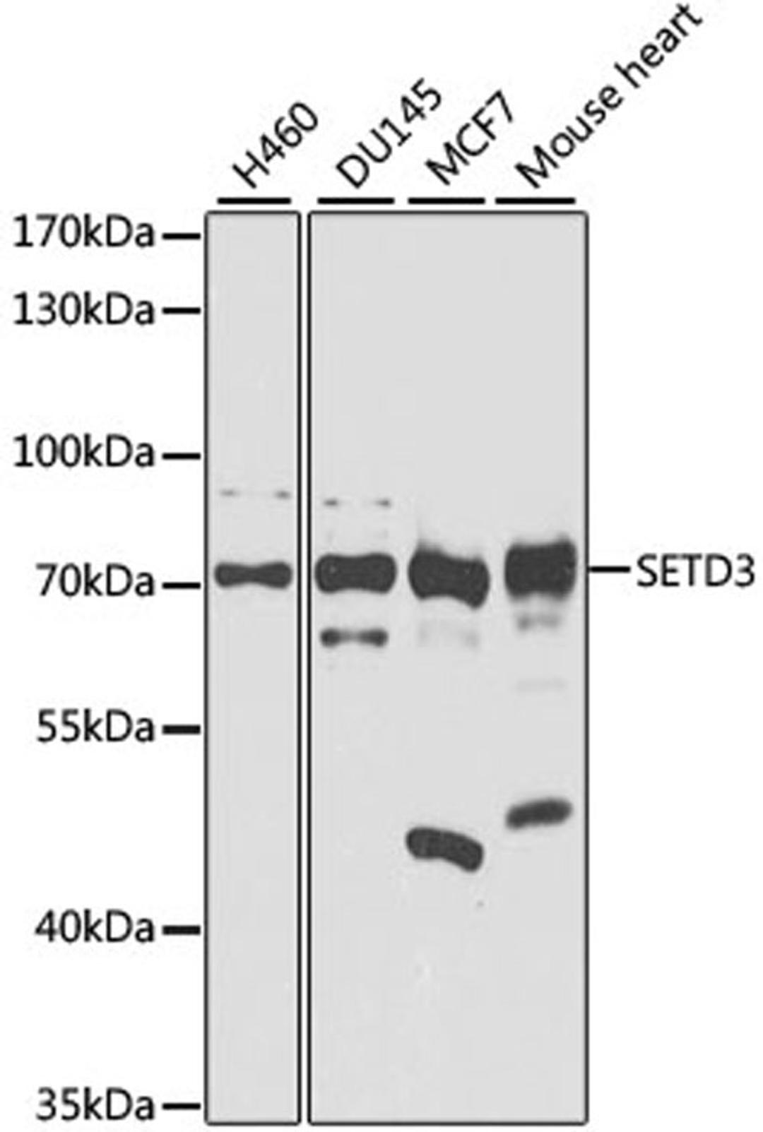 Western blot - SETD3 antibody (A8071)