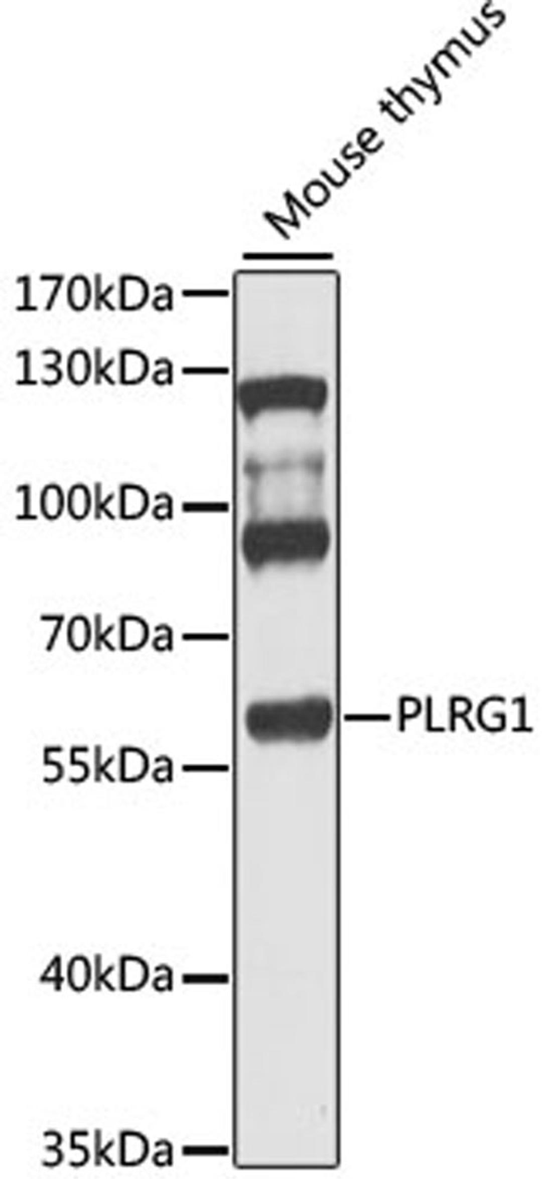 Western blot - PLRG1 antibody (A9946)