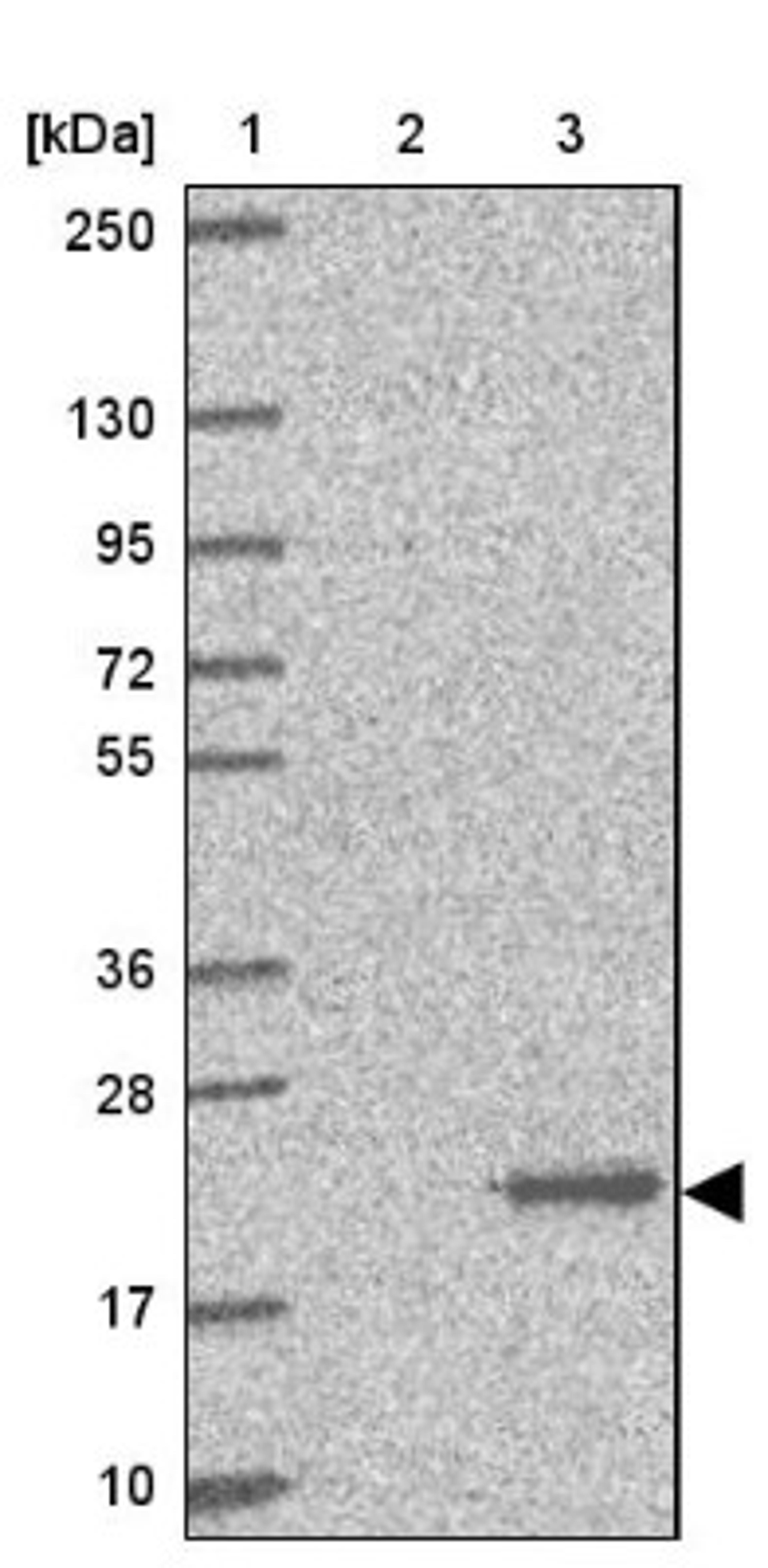 Western Blot: dUTPase Antibody [NBP2-33277] - Lane 1: Marker [kDa] 250, 130, 95, 72, 55, 36, 28, 17, 10<br/>Lane 2: Human cell line RT-4<br/>Lane 3: Human cell line U-251MG sp