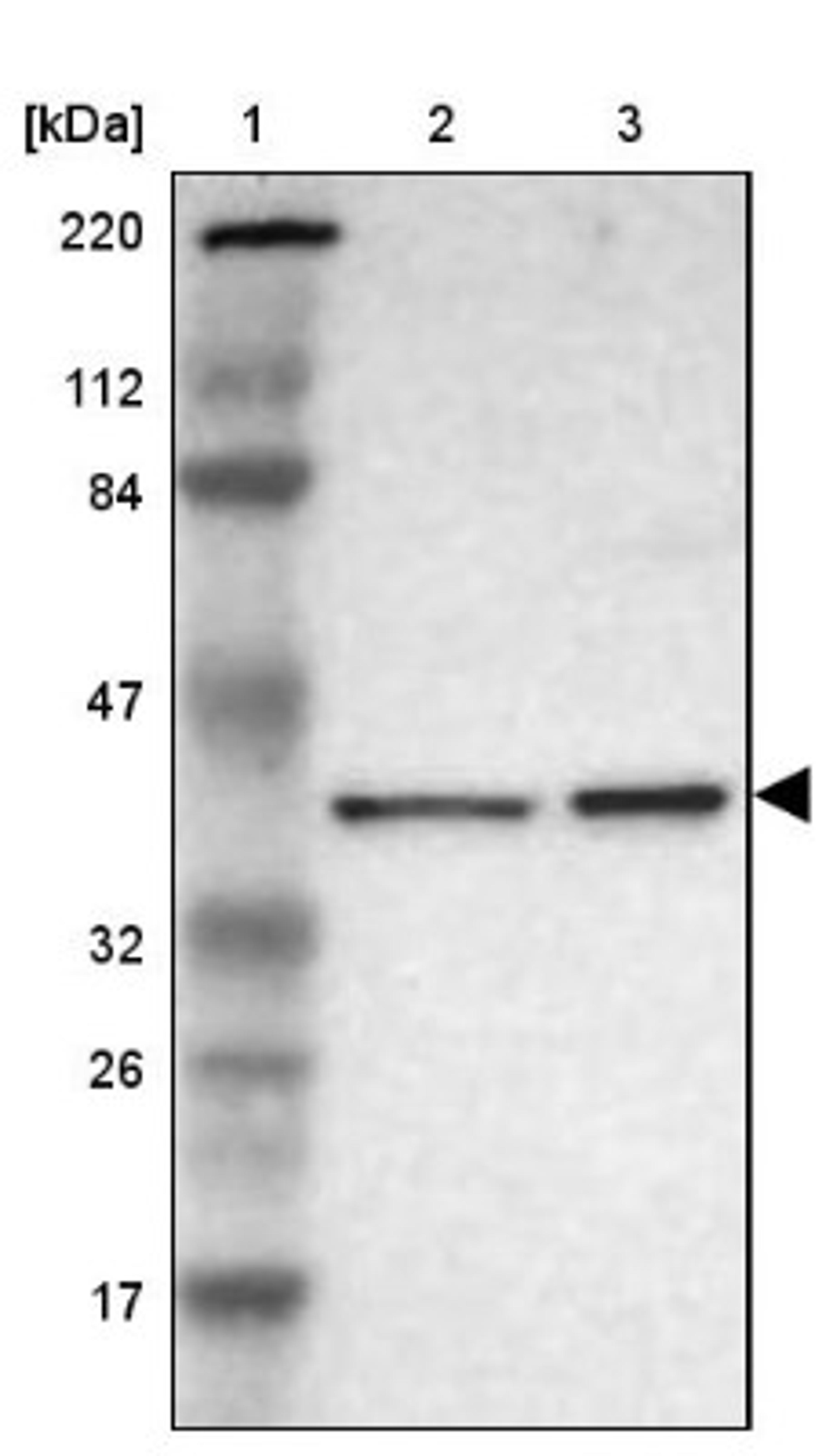 Western Blot: Dlx5 Antibody [NBP1-85793] - Lane 1: Marker [kDa] 220, 112, 84, 47, 32, 26, 17<br/>Lane 2: Human cell line RT-4<br/>Lane 3: Human cell line U-251MG sp