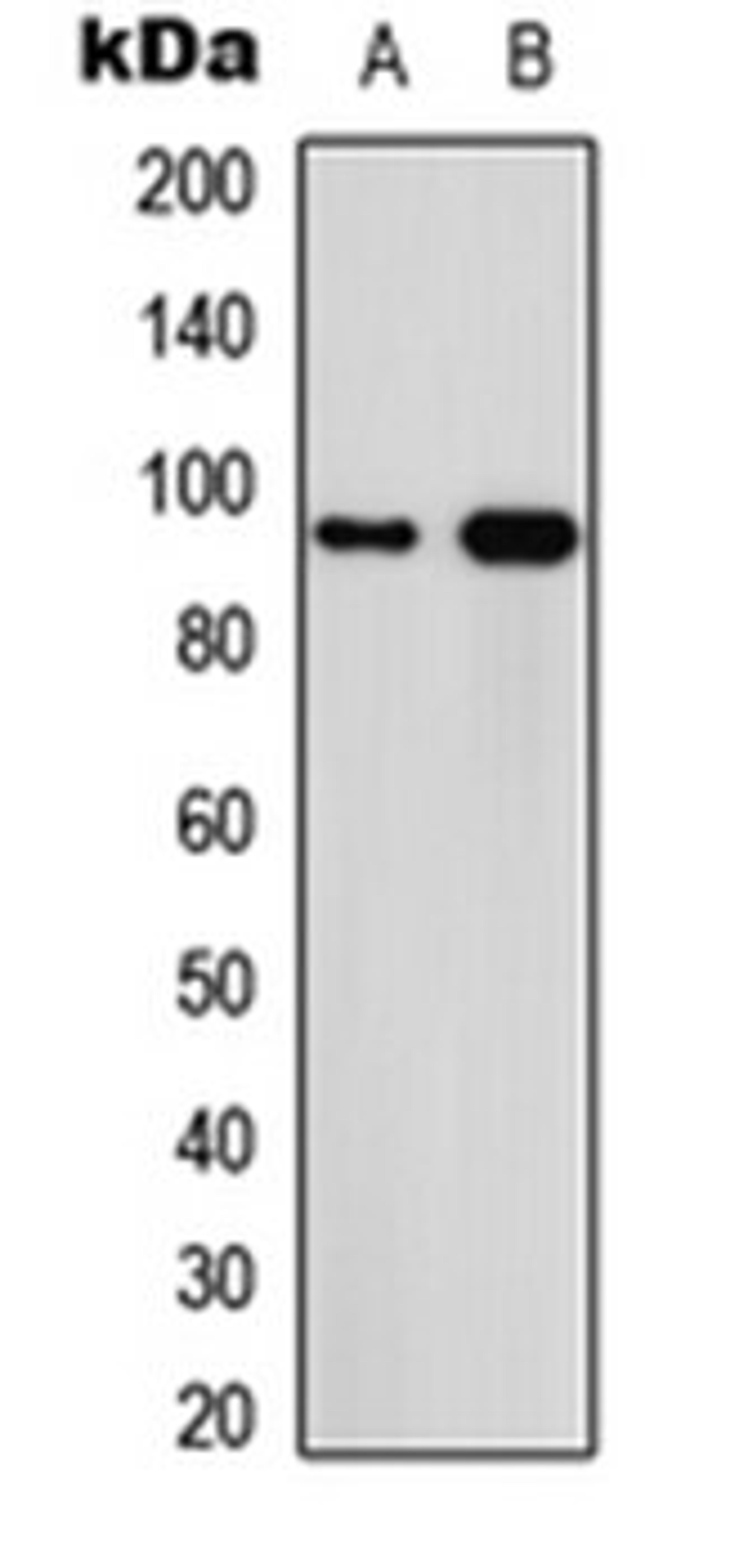 Western blot analysis of MCF7 (Lane 1), PC12 (Lane 2) whole cell lysates using Calpain 3 antibody