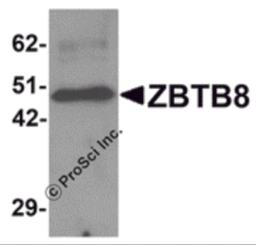 Western blot analysis of ZBTB8 in mouse spleen tissue lysate with ZBTB8 antibody at 1 &#956;g/mL.