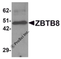Western blot analysis of ZBTB8 in mouse spleen tissue lysate with ZBTB8 antibody at 1 μg/mL.