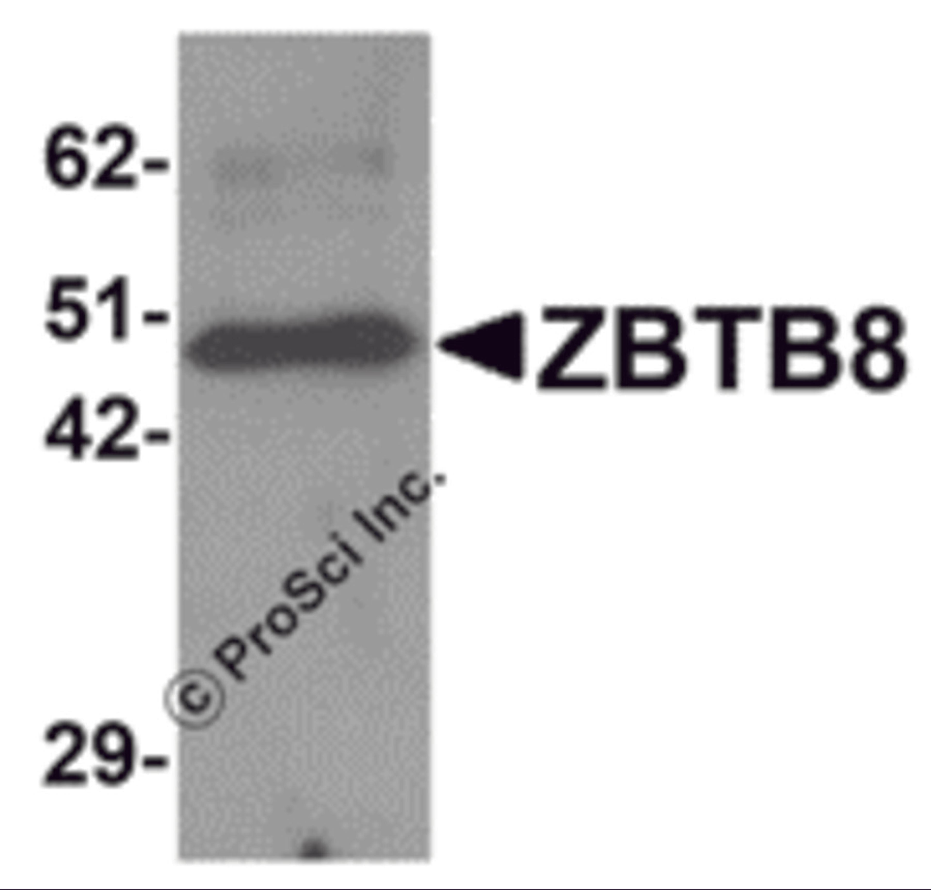 Western blot analysis of ZBTB8 in mouse spleen tissue lysate with ZBTB8 antibody at 1 μg/mL.