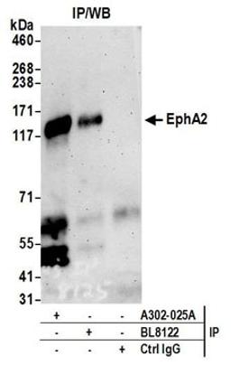 Detection of human EphA2 by western blot of immunoprecipitates.