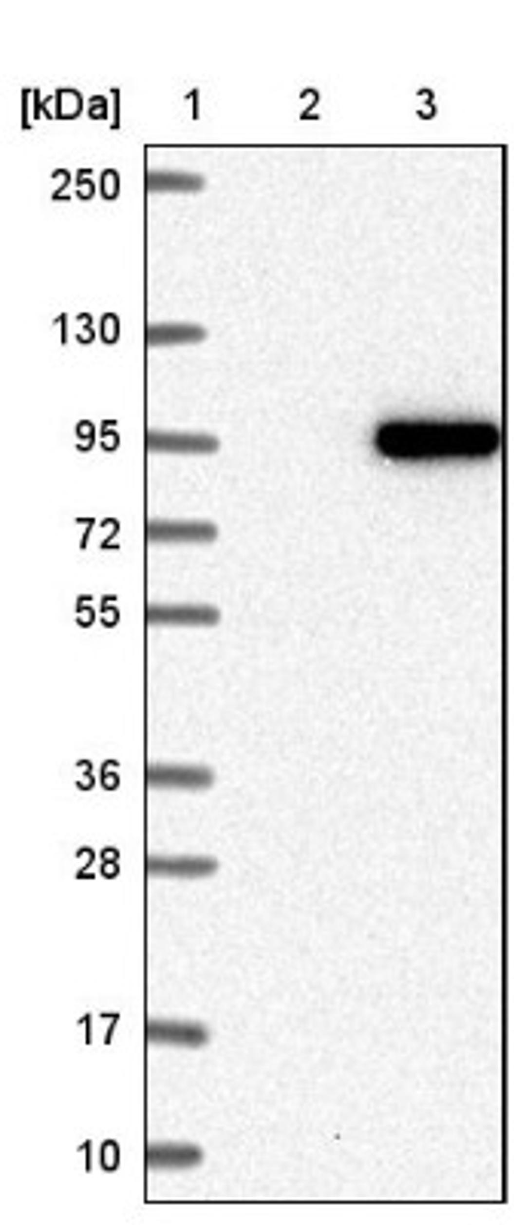 Western Blot: COG7 Antibody [NBP2-47502] - Lane 1: Marker [kDa] 250, 130, 95, 72, 55, 36, 28, 17, 10.  Lane 2: Negative control (vector only transfected HEK293T lysate).  Lane 3: Over-expression lysate (Co-expressed with a C-terminal myc-DDK tag (3.1 kDa) in mammalian HEK293T cells).