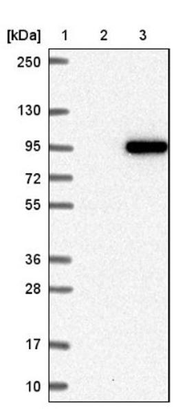 Western Blot: COG7 Antibody [NBP2-47502] - Lane 1: Marker [kDa] 250, 130, 95, 72, 55, 36, 28, 17, 10.  Lane 2: Negative control (vector only transfected HEK293T lysate).  Lane 3: Over-expression lysate (Co-expressed with a C-terminal myc-DDK tag (3.1 kDa) in mammalian HEK293T cells).