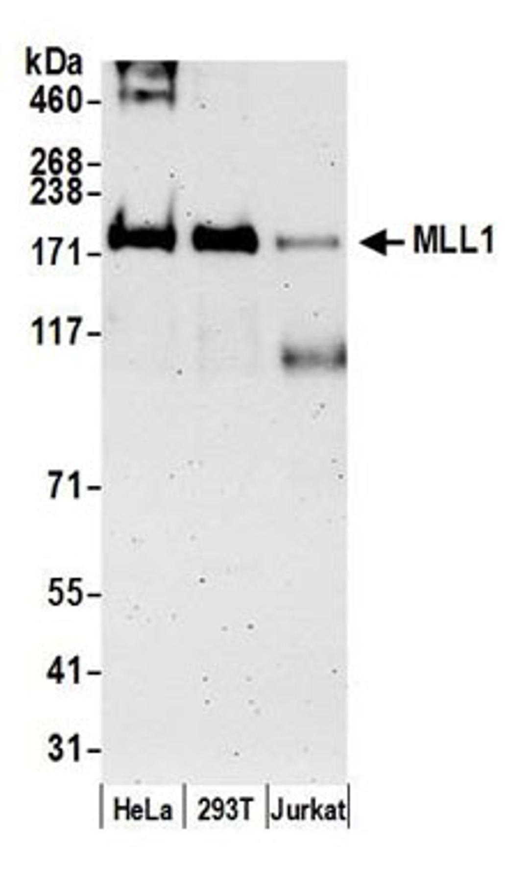 Detection of human MLL1 by western blot.