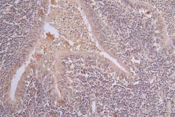 IHC image of CSB-RA101461A0HU diluted at 1:50 and staining in paraffin-embedded human lung tissue performed on a Leica BondTM system. After dewaxing and hydration, antigen retrieval was mediated by high pressure in a citrate buffer (pH 6.0). Section was blocked with 10% normal goat serum 30min at RT. Then primary antibody (1% BSA) was incubated at 4°C overnight. The primary is detected by a Goat anti-rabbit polymer IgG labeled by HRP and visualized using 0.63% DAB.