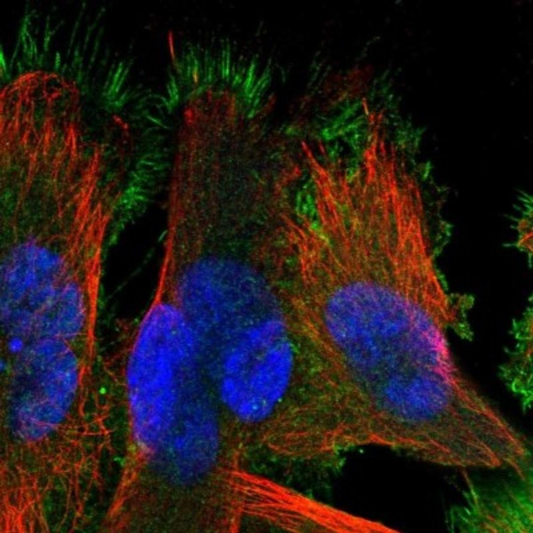 Immunocytochemistry/Immunofluorescence: SLC10A5 Antibody [NBP1-85965] - Immunofluorescent staining of human cell line U-251MG shows positivity in plasma membrane.