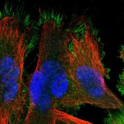 Immunocytochemistry/Immunofluorescence: SLC10A5 Antibody [NBP1-85965] - Immunofluorescent staining of human cell line U-251MG shows positivity in plasma membrane.