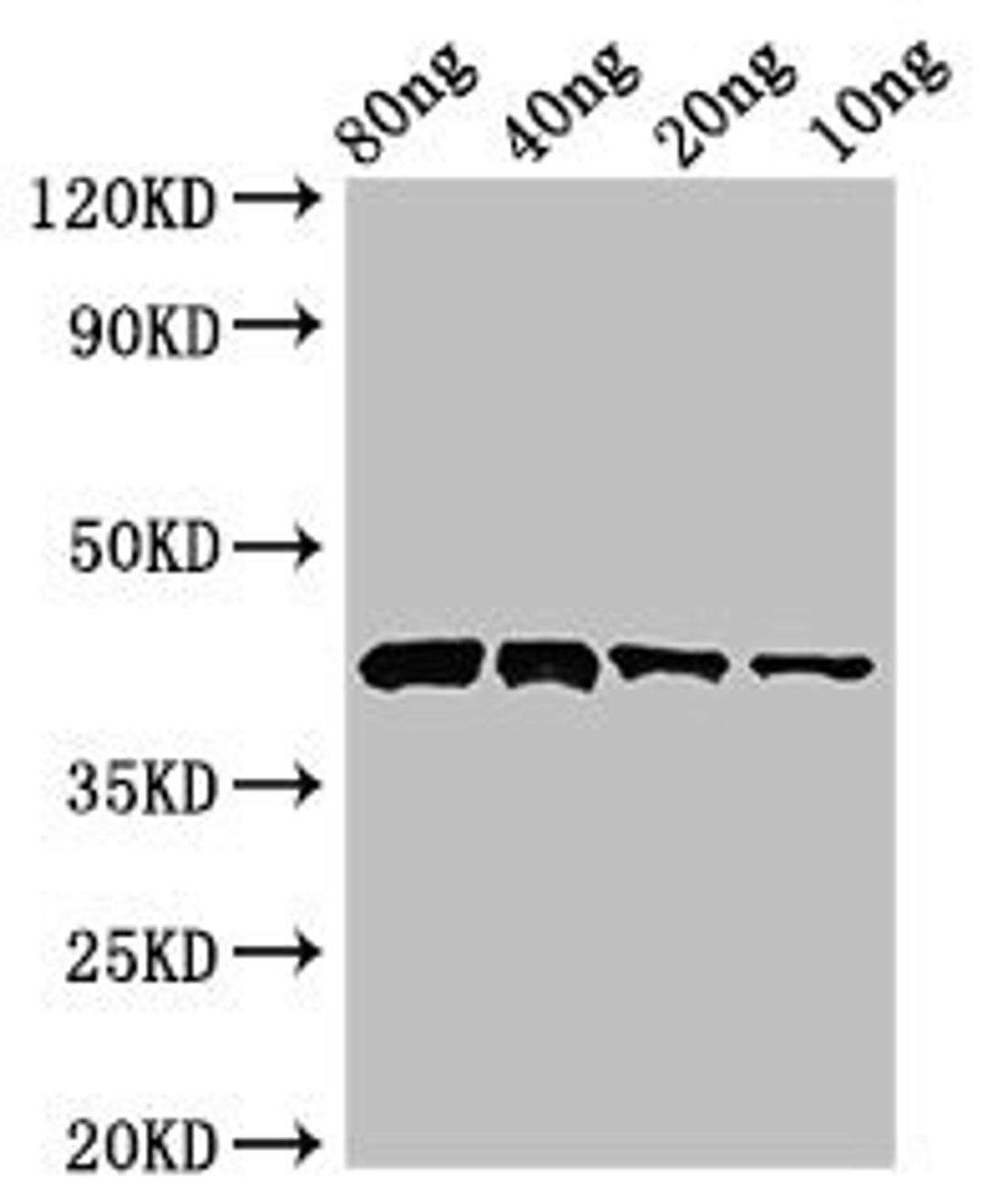 Western Blot. Positive WB detected in Recombinant protein. All lanes: Pectate lyase 1 antibody at 3µg/ml. Secondary. Goat polyclonal to rabbit IgG at 1/50000 dilution. Predicted band size: 43 kDa. Observed band size: 43 kDa