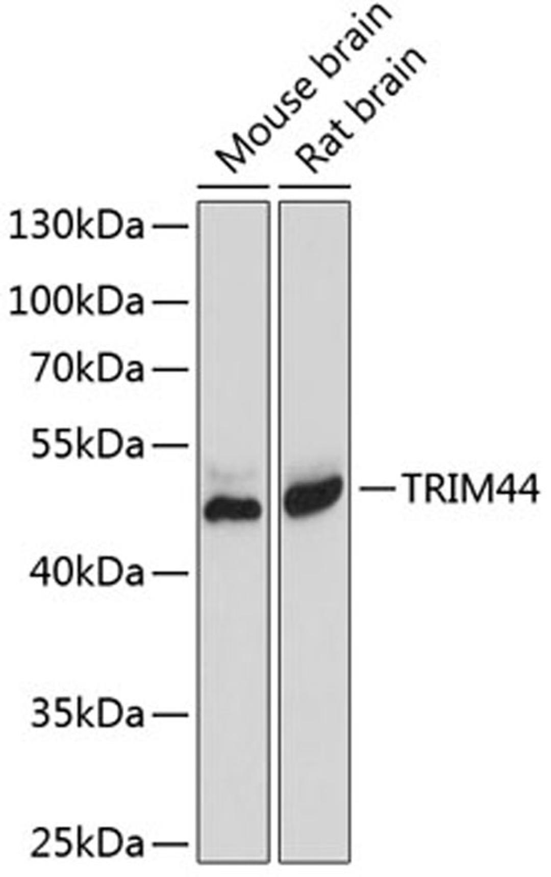 Western blot - TRIM44 antibody (A8719)