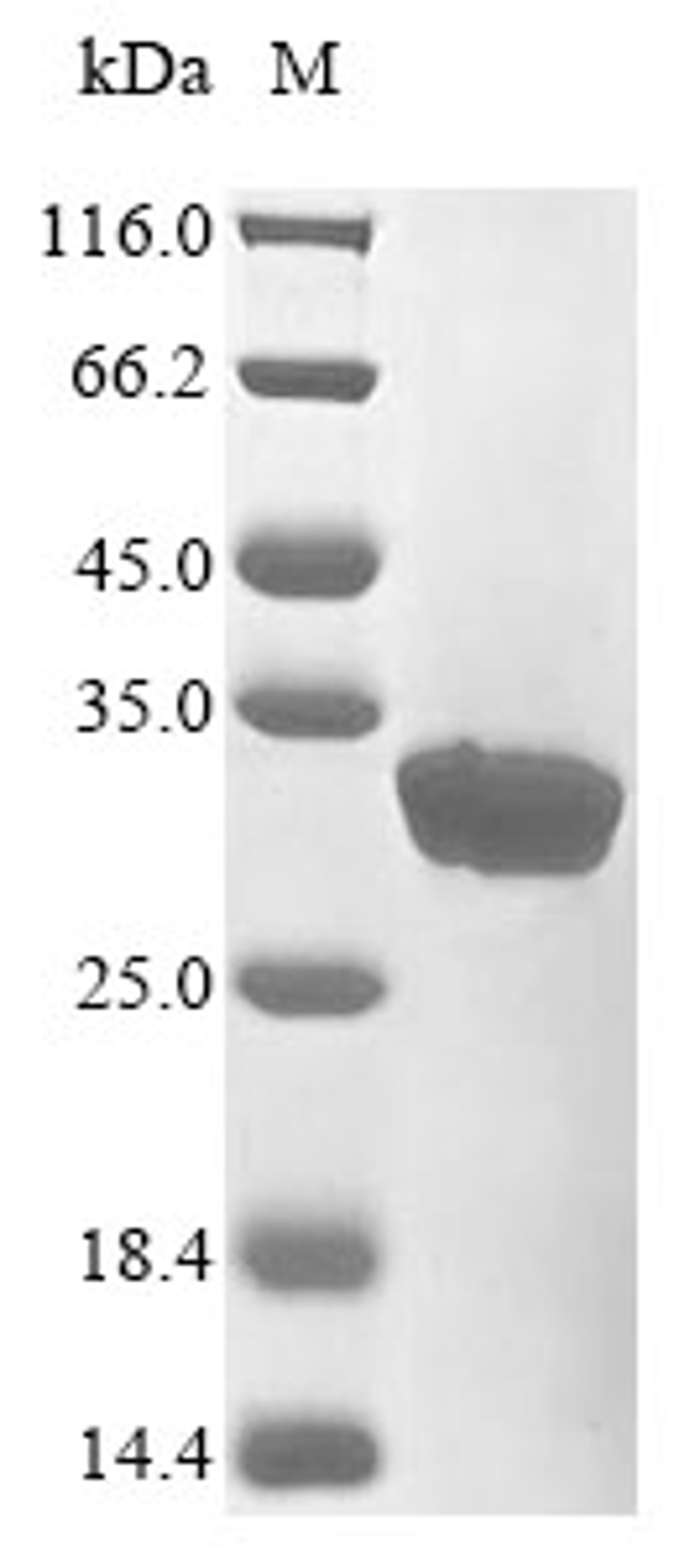 (Tris-Glycine gel) Discontinuous SDS-PAGE (reduced) with 5% enrichment gel and 15% separation gel.