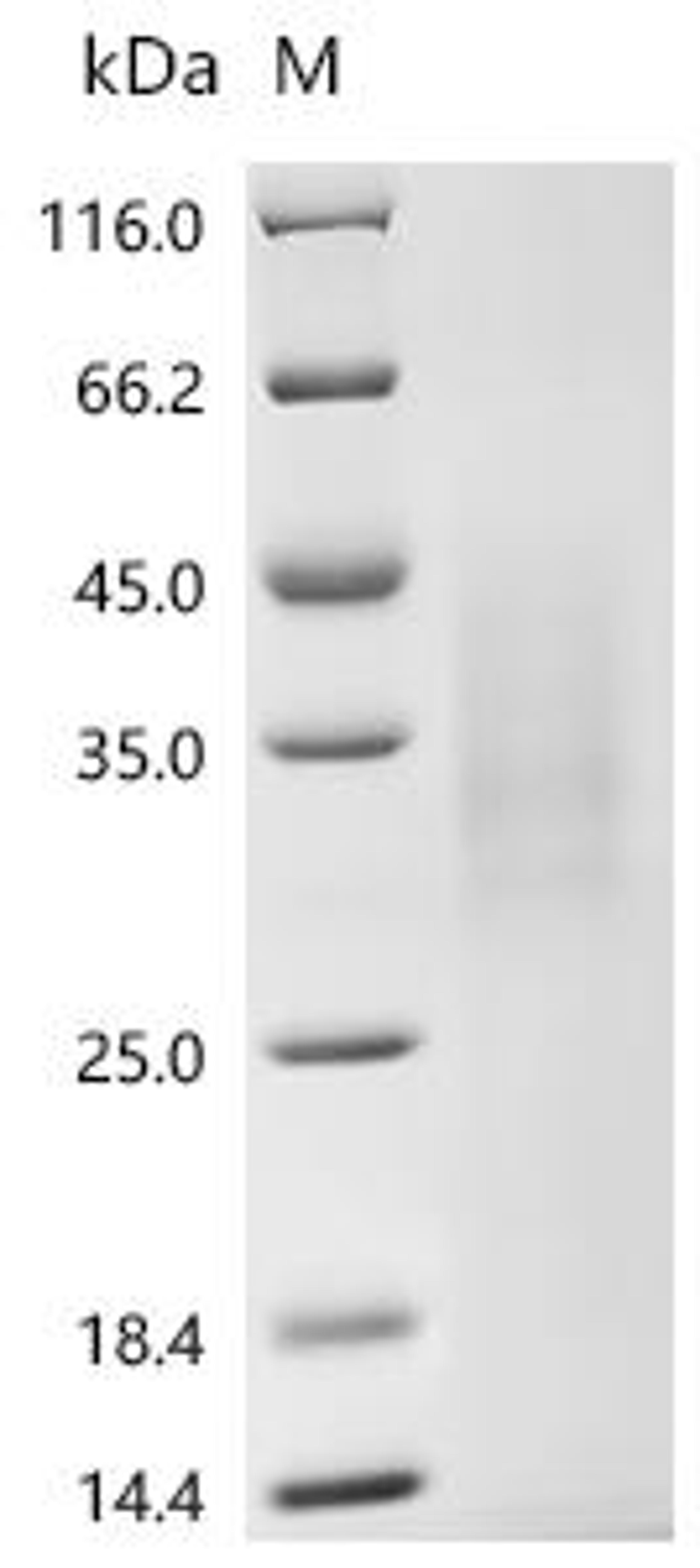 (Tris-Glycine gel) Discontinuous SDS-PAGE (reduced) with 5% enrichment gel and 15% separation gel.