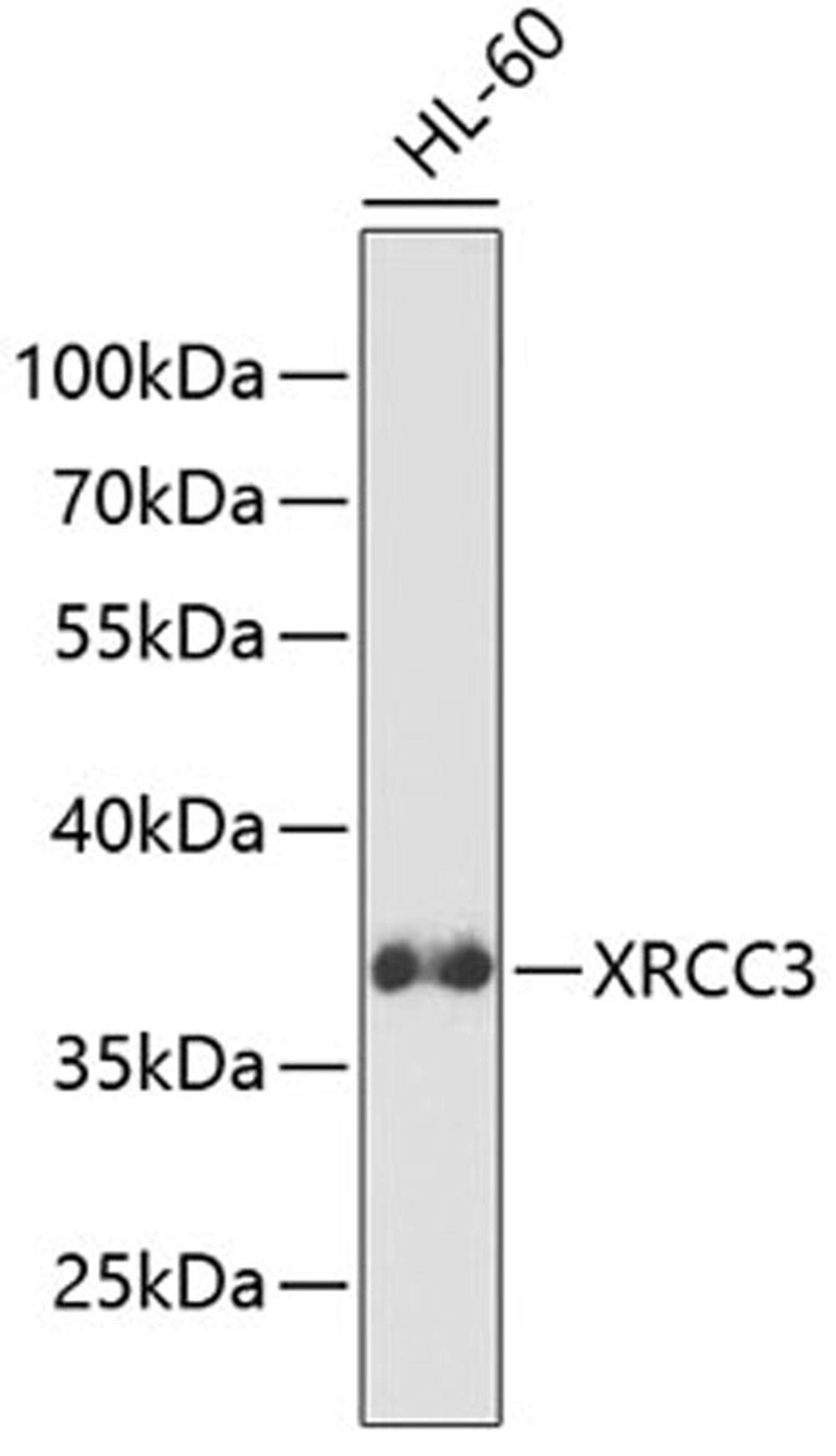 Western blot - XRCC3 antibody (A2134)