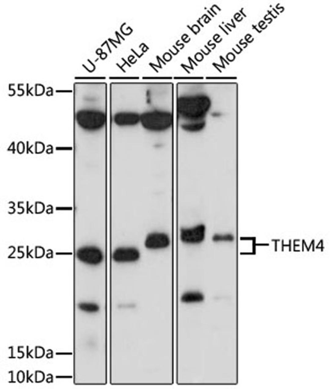 Western blot - THEM4 antibody (A15940)