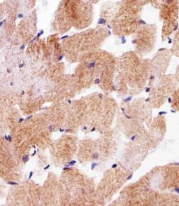 Immunohistochemical analysis of paraffin-embedded H. skeletal muscle section using SDHA Antibody . Antibody was diluted at 1:25 dilution. A undiluted biotinylated goat polyvalent antibody was used as the secondary, followed by DAB staining.