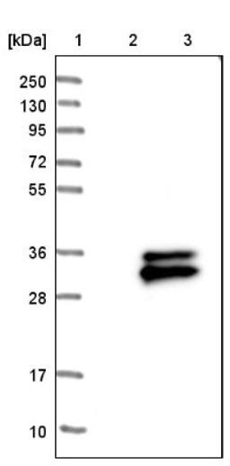 Western Blot: TMEM176A Antibody [NBP1-83283] - Lane 1: Marker [kDa] 250, 130, 95, 72, 55, 36, 28, 17, 10<br/>Lane 2: Negative control (vector only transfected HEK293T lysate)<br/>Lane 3: Over-expression lysate (Co-expressed with a C-terminal myc-DDK tag (~3.1 kDa) in mammalian HEK293T cells, LY413014)