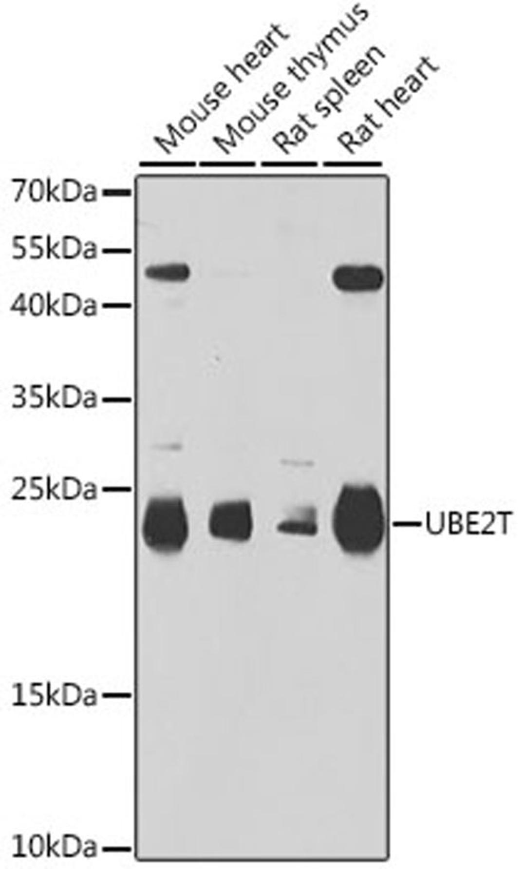 Western blot - UBE2T antibody (A6853)