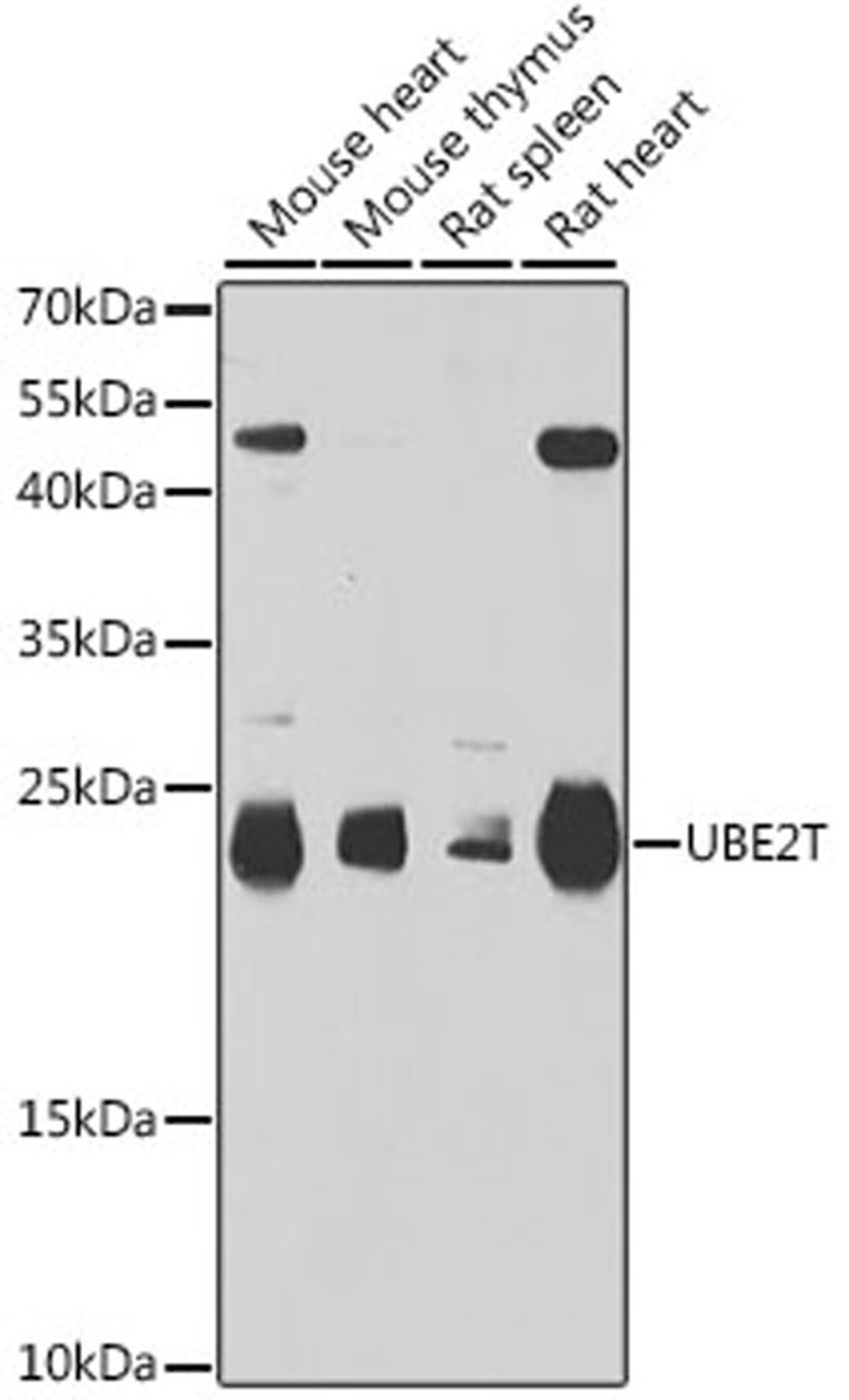 Western blot - UBE2T antibody (A6853)