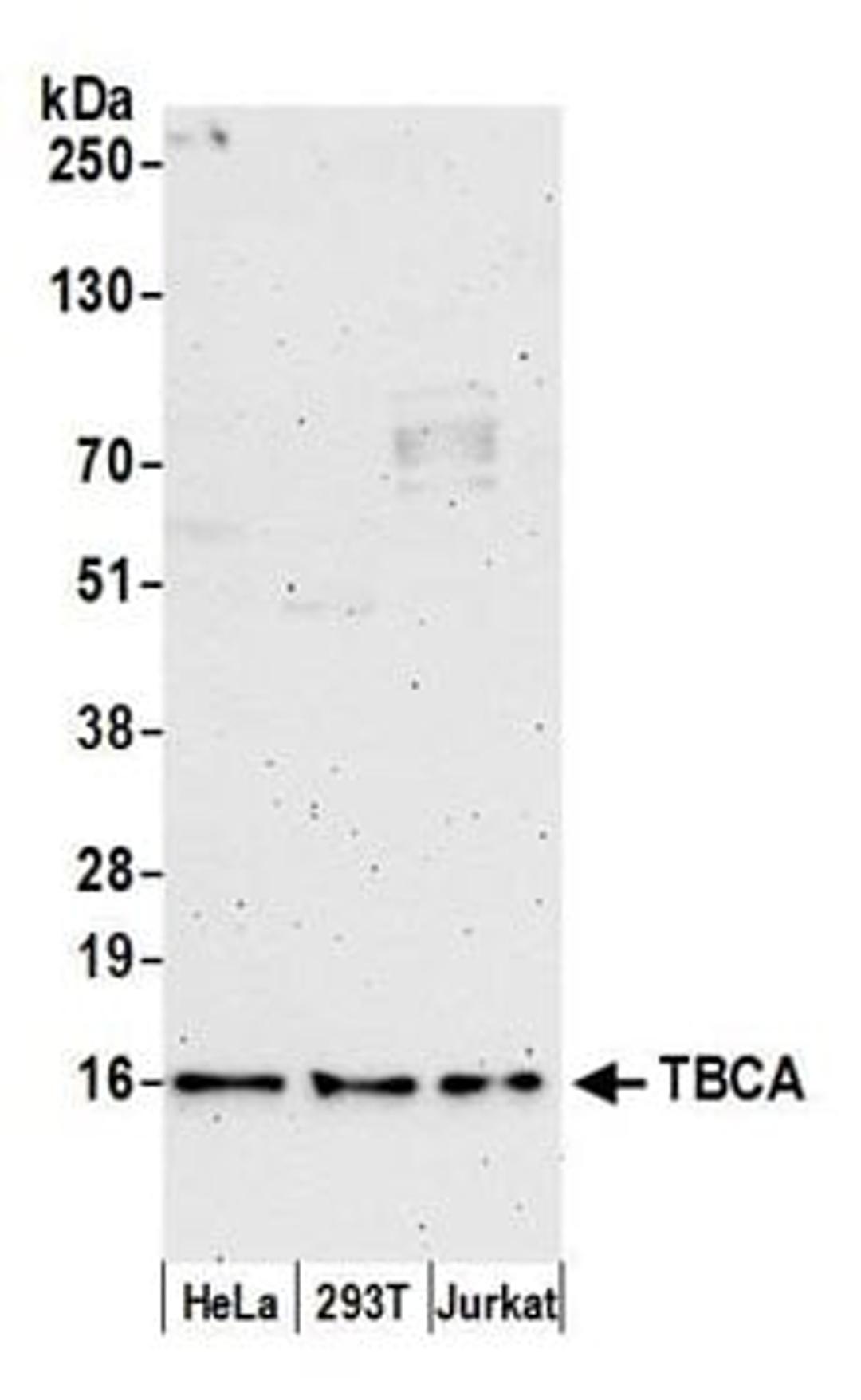 Detection of human TBCA by western blot.