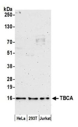 Detection of human TBCA by western blot.