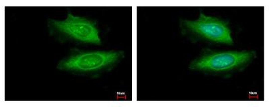 Immunocytochemistry: VCPIP1 Antibody [NBP1-32663] -  HeLa cells were fixed in -20C 100% MeOH for 5 min. Green: VCPIP1 protein stained by VCPIP1 antibody, C-term diluted at 1:500. Blue: Hoechst 33343 staining.