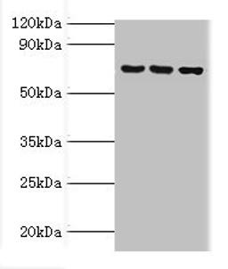 Western blot. All lanes: ABCF2 antibody at 4ug/ml. Lane 1: 293T whole cell lysate. Lane 2: Hela whole cell lysate. Lane 3: NIH/3T3 whole cell lysate. Secondary. Goat polyclonal to rabbit IgG at 1/10000 dilution. Predicted band size: 72, 73 kDa. Observed band size: 72 kDa. 